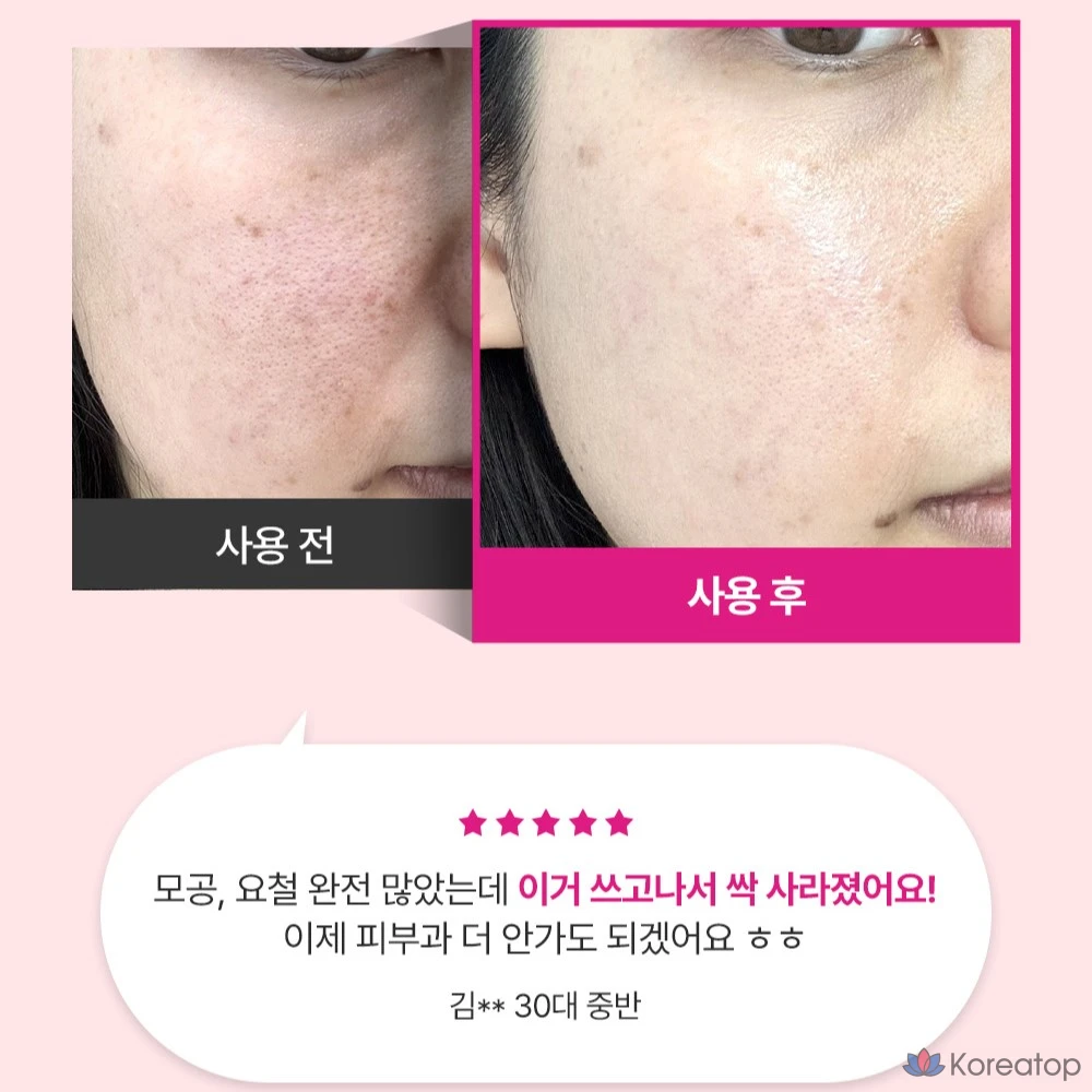 Ампульная сыворотка Sungboon Editor Pink Apple Pore Tightening Hyaluronic Acid Ampoule, 30 мл, 1 шт.