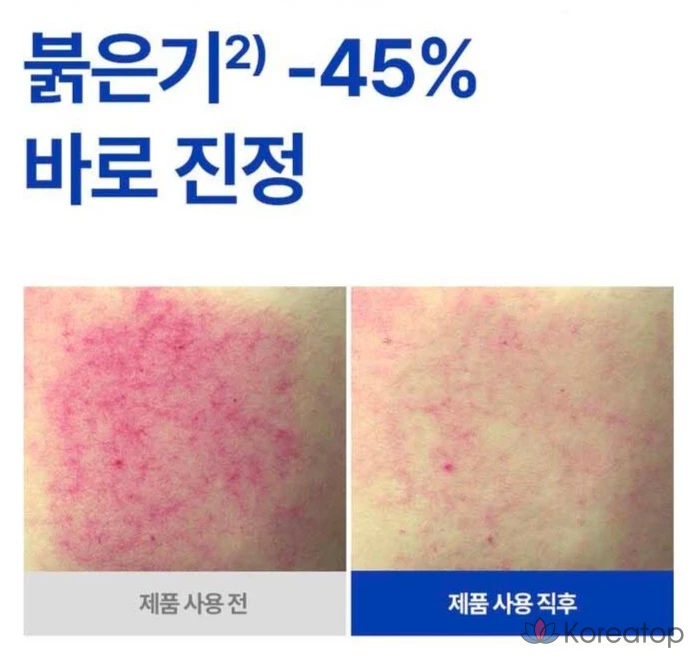 Ампульная сыворотка Isoi Acne Doctor First Speedy Spot Ampoule, 14 мл, 1 шт.