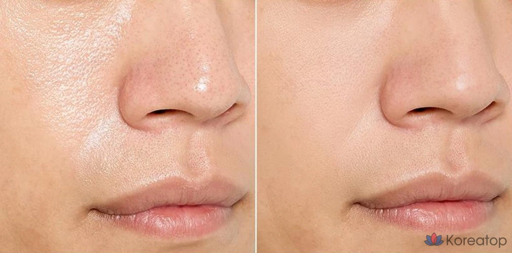 Пилинг-маска OBge Pore Zero Mousse Clay Pack, 1 шт.