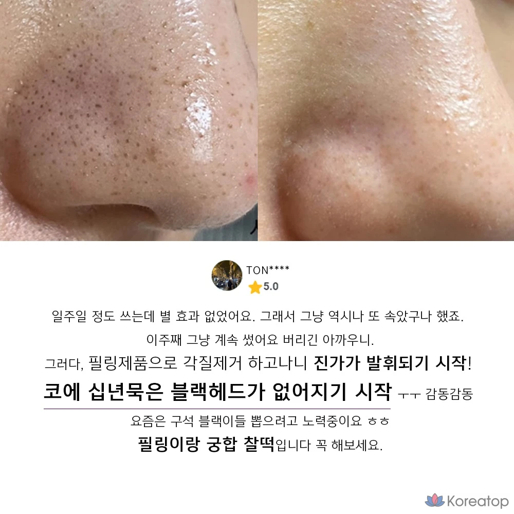 Ампульная сыворотка ANACIS Acleon Blackhead Pore Softening Ampoule 2 Types, 215 мл, 1 шт.