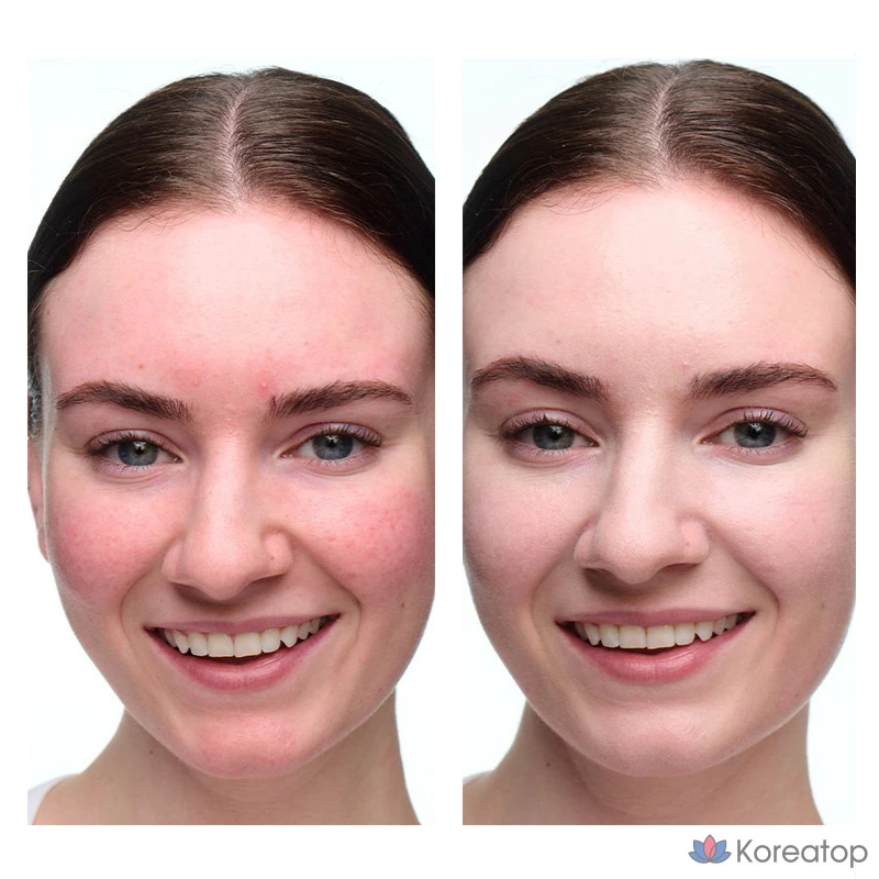 Корректирующее средство Dr. Jart+ Cicapair Soothing Color Correcting Treatment, 15 мл, 1 шт.