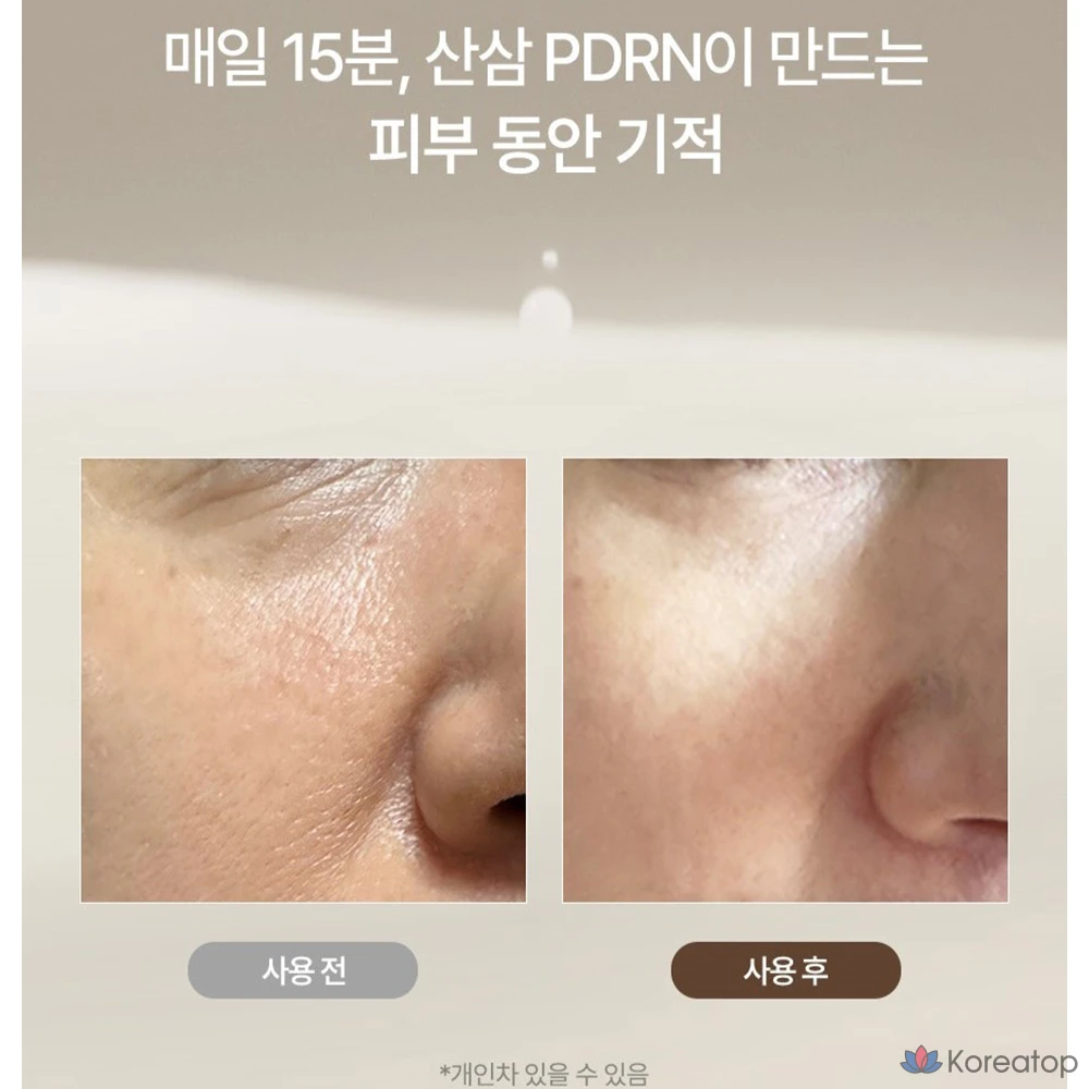 Тканевая маска для лица Milk Touch Sansam Gold PDRN Daily Special Mask, 30 шт., фото 2