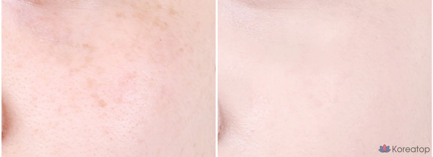 Кушон ABOUT TONE Skin Layer Fit Cushion Foundation, оттенок 21 Warm Light, 13 г, 1 шт., фото 6