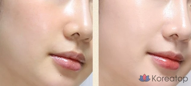 Солнцезащитный BB-крем FMGT New Gold Collagen Ampoule Sun BB Cream SPF50+ PA+++, 40 мл, 1 шт.