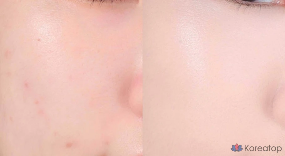 Тонер ABOUT TONE Skin Layer Cover Fit Concealer, оттенок 21 Cool Light, 5.6 г, 1 шт., фото 6