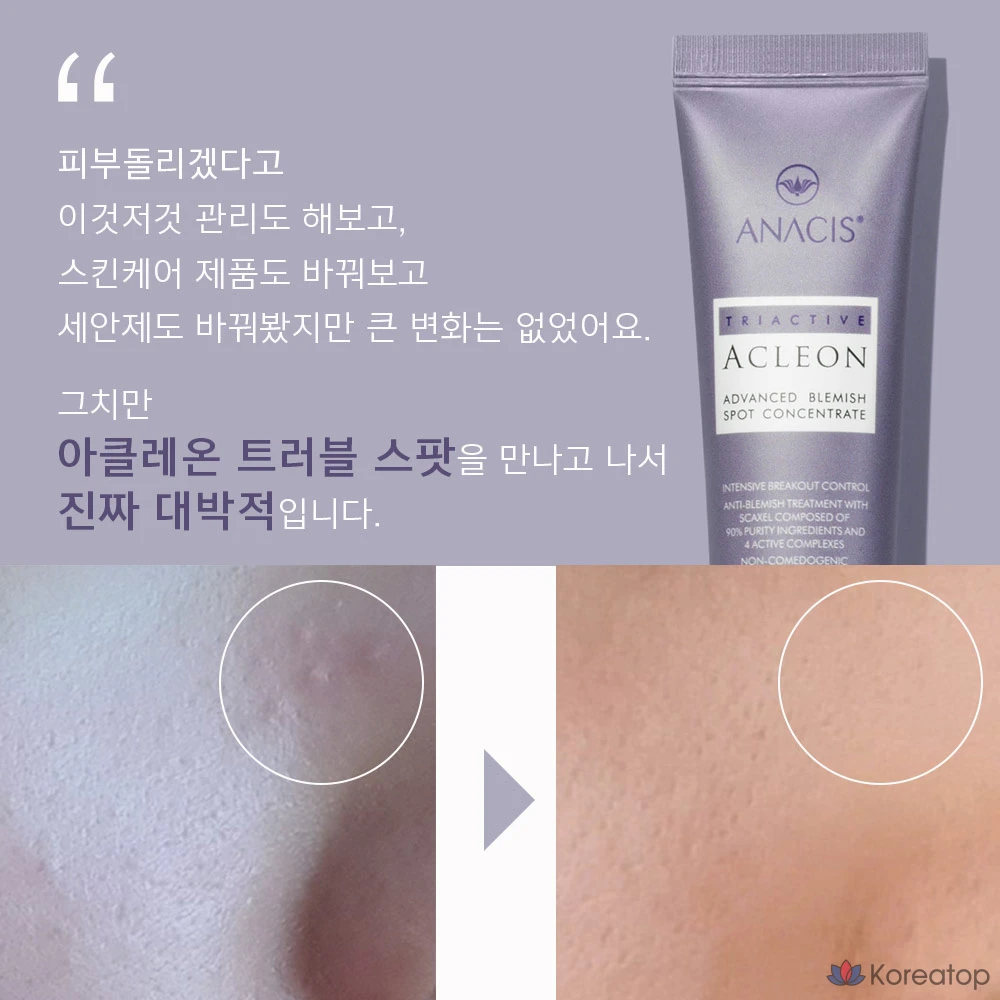 Крем для лица ANACLEON Skin Acne Tea Tree Cica Spot, 30 мл, 1 шт.
