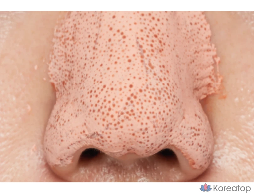 Маска для лица Missha Amazon Red Clay Pore Mask, 110 мл, 2 шт., фото 8