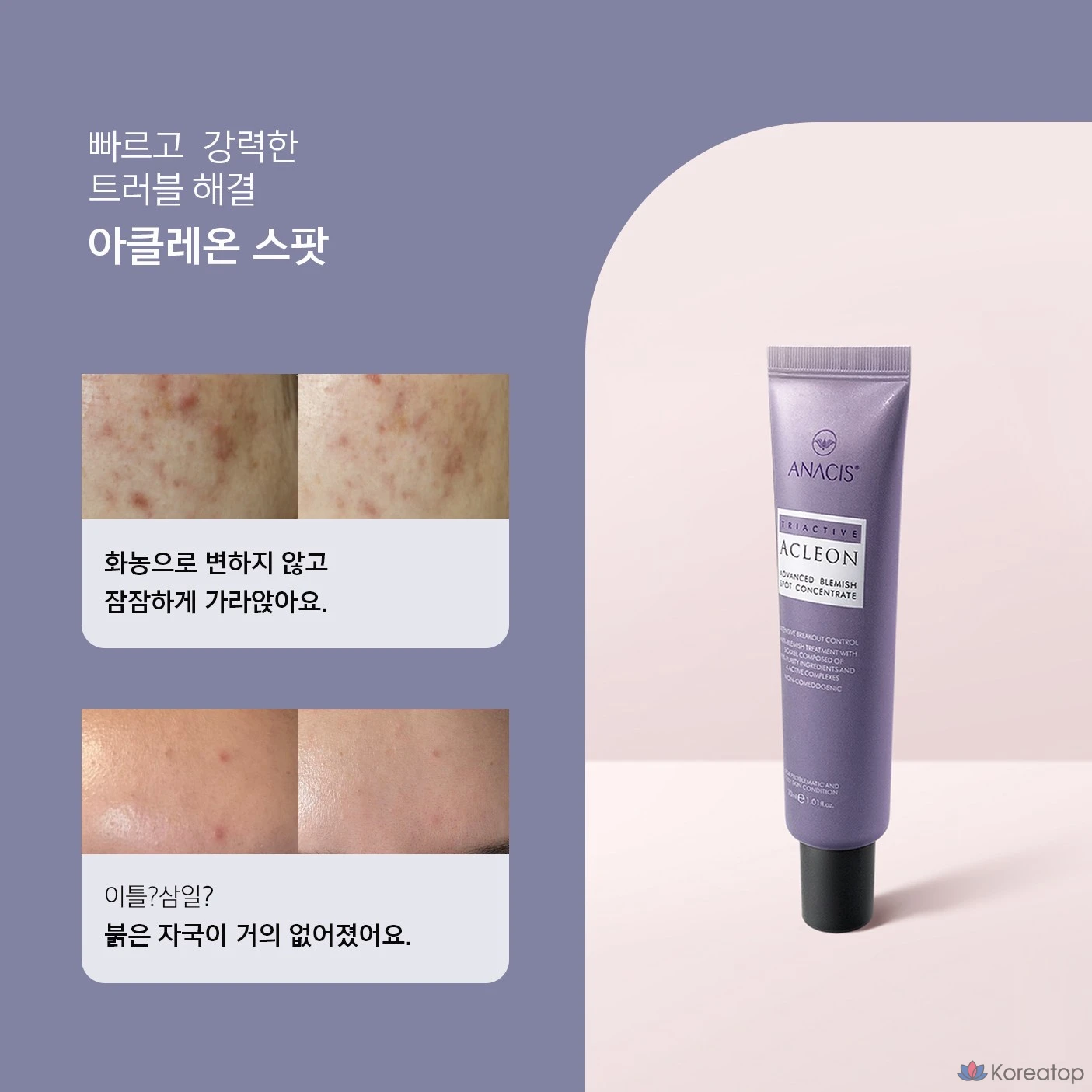 Крем для лица ANACLEON Skin Acne Tea Tree Cica Spot, 30 мл, 1 шт.