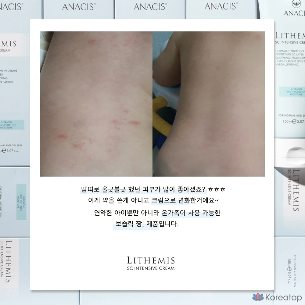 Крем для лица ANACIS Intensive High-Moisture Barrier Cream, 200 г, 1 шт.