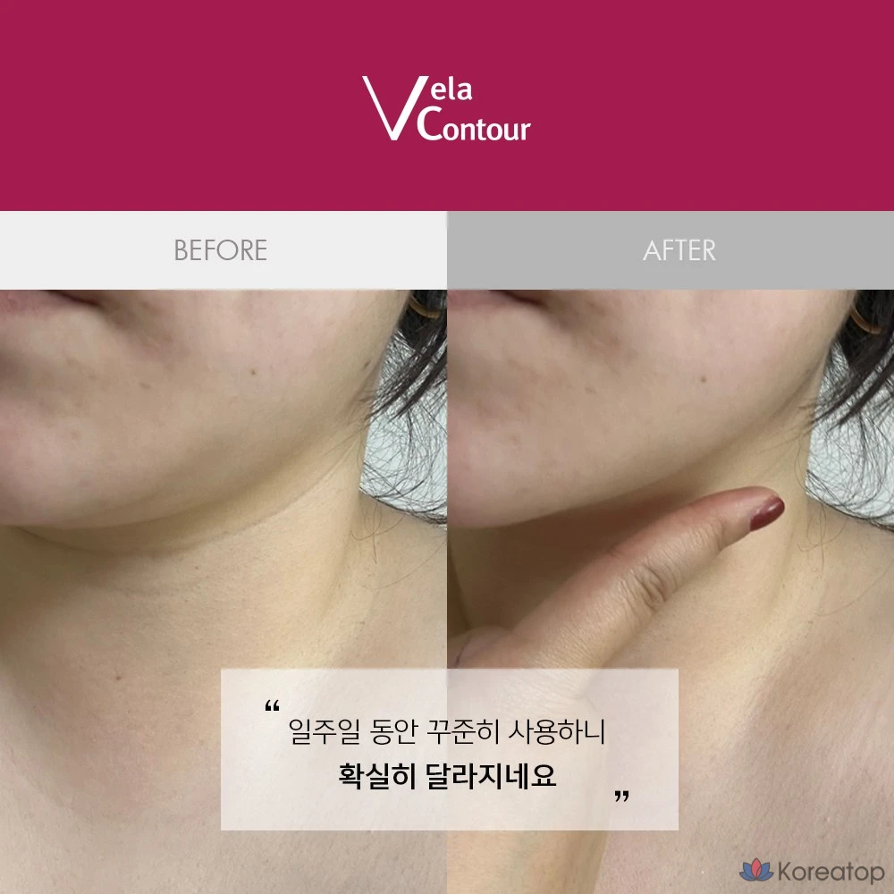 Ампульная сыворотка ANACIS Bella Contour Botox Deep Ball Lifting Ampoule, 30 мл, 50.5 г, 1 шт.