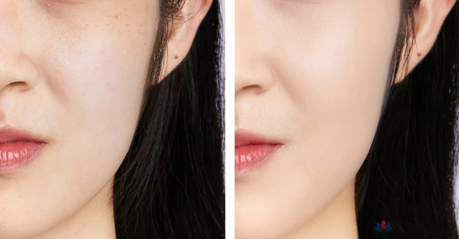Кушон Isoi Skincare Cushion Foundation Refill, оттенок 21, 13 г, 1 шт.