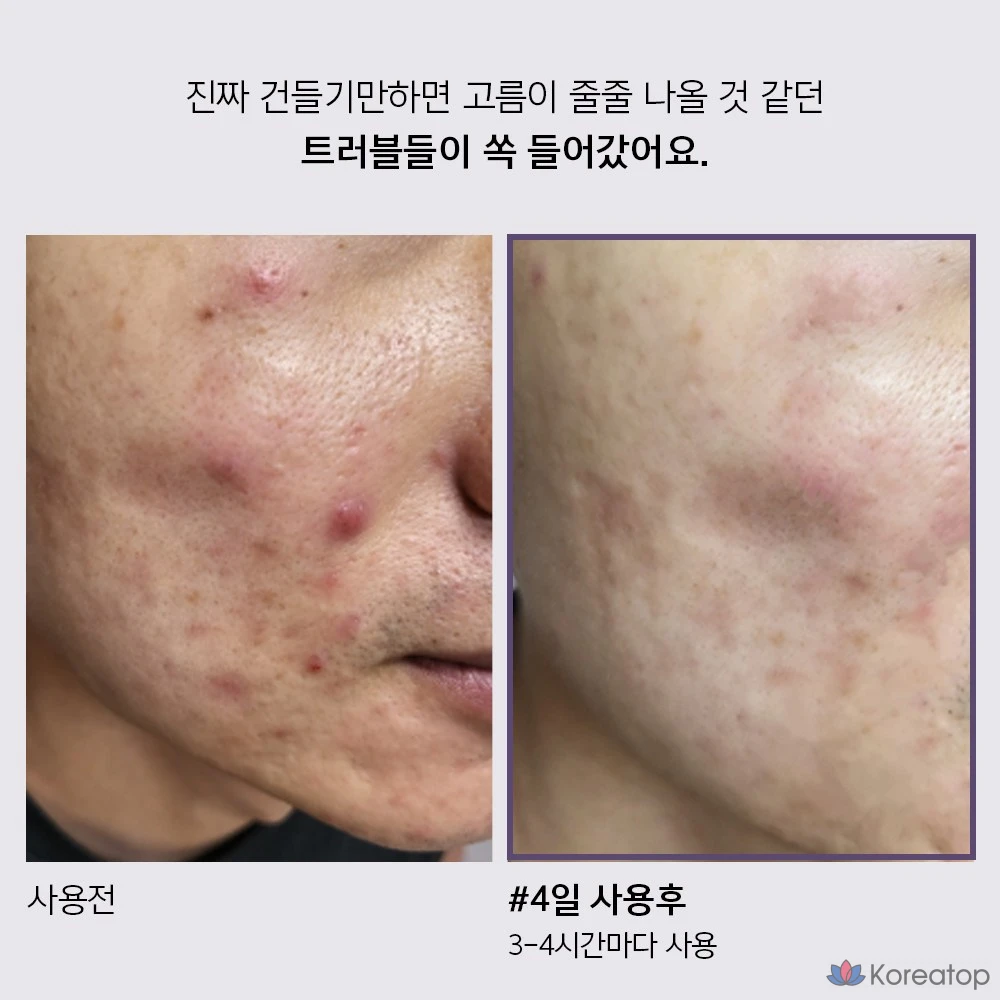 Крем для лица ANACLEON Skin Acne Tea Tree Cica Spot, 30 мл, 1 шт.
