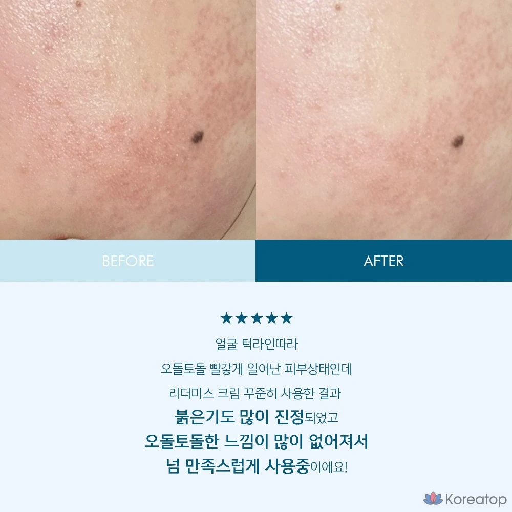 Крем для лица ANACIS Intensive High-Moisture Barrier Cream, 200 г, 1 шт.