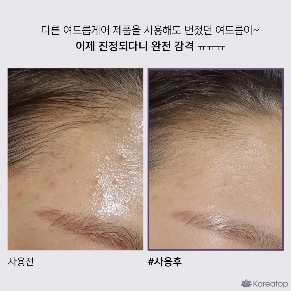 Крем для лица ANACLEON Skin Acne Tea Tree Cica Spot, 30 мл, 1 шт.