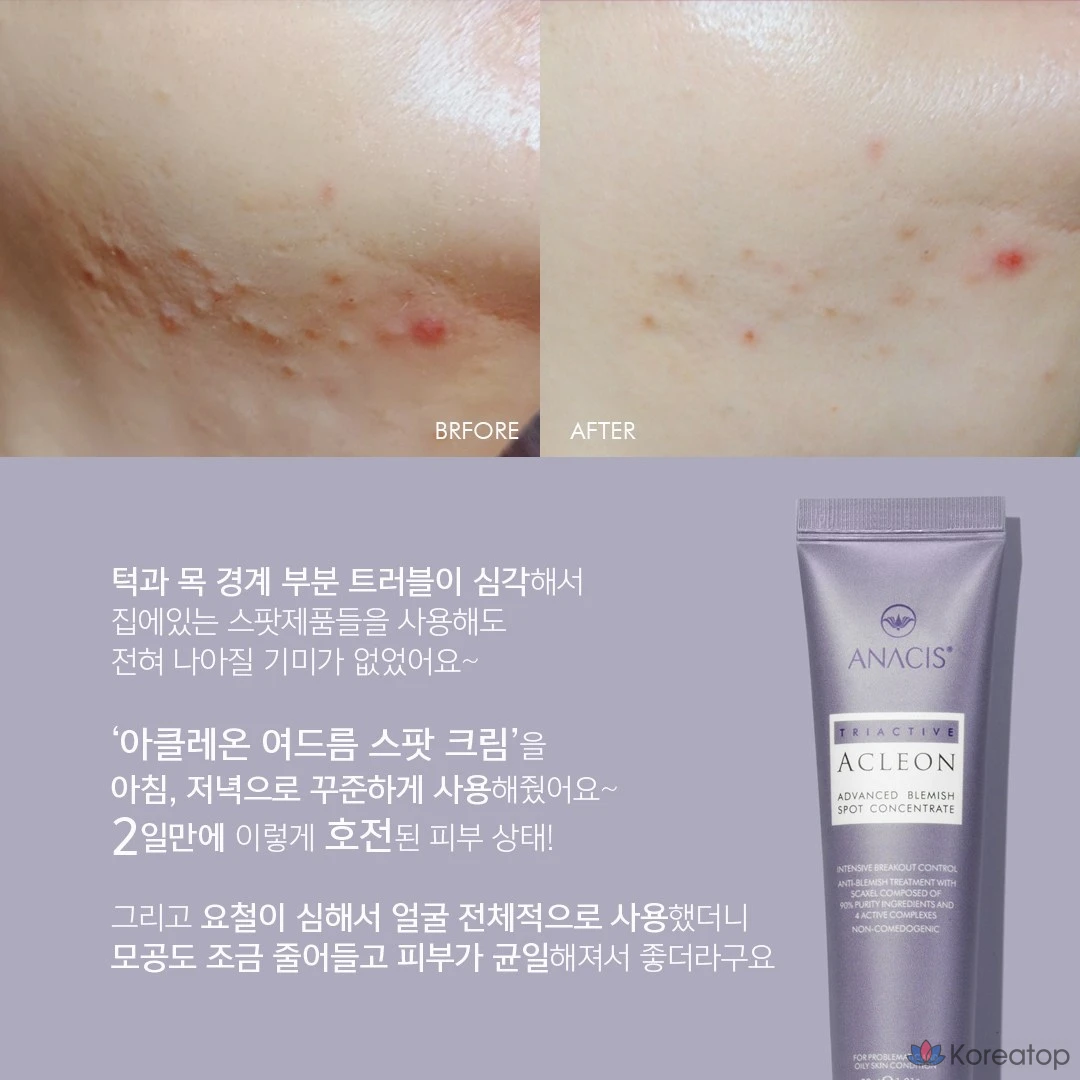 Крем для лица ANACLEON Skin Acne Tea Tree Cica Spot, 30 мл, 1 шт.