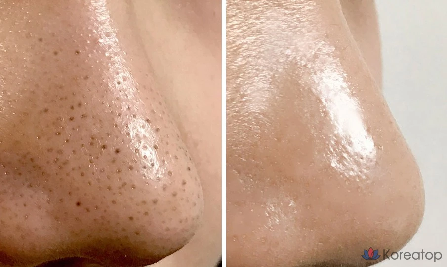 Пилинг One-Day's You Pore Softener No More Blackhead, 100 мл, 1 шт.
