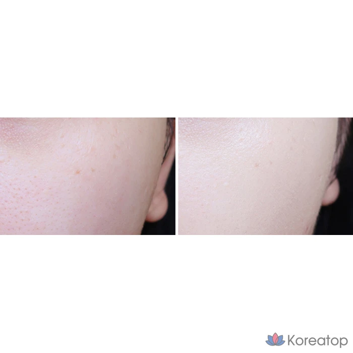 BB-крем MIBA Ion Calcium Mineral, SPF50+ PA+++, 50 мл, 1 шт.