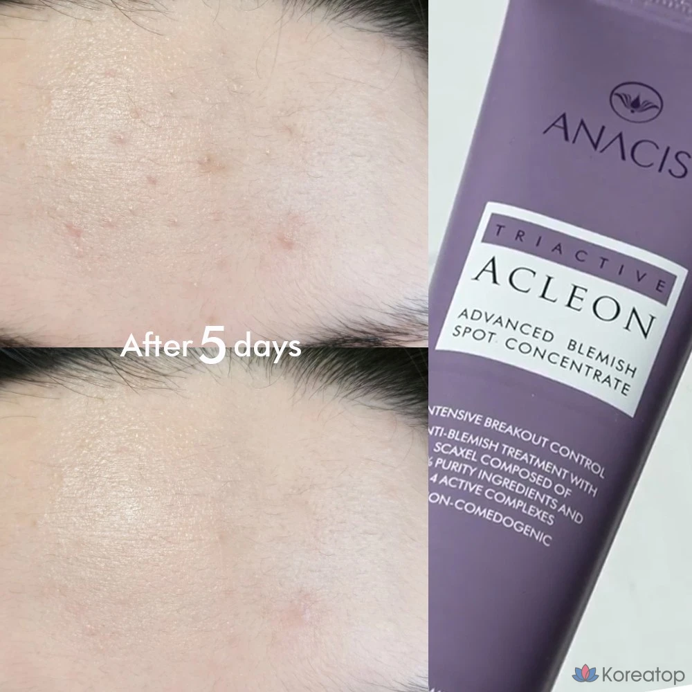 Крем для лица ANACLEON Skin Acne Tea Tree Cica Spot, 30 мл, 1 шт.