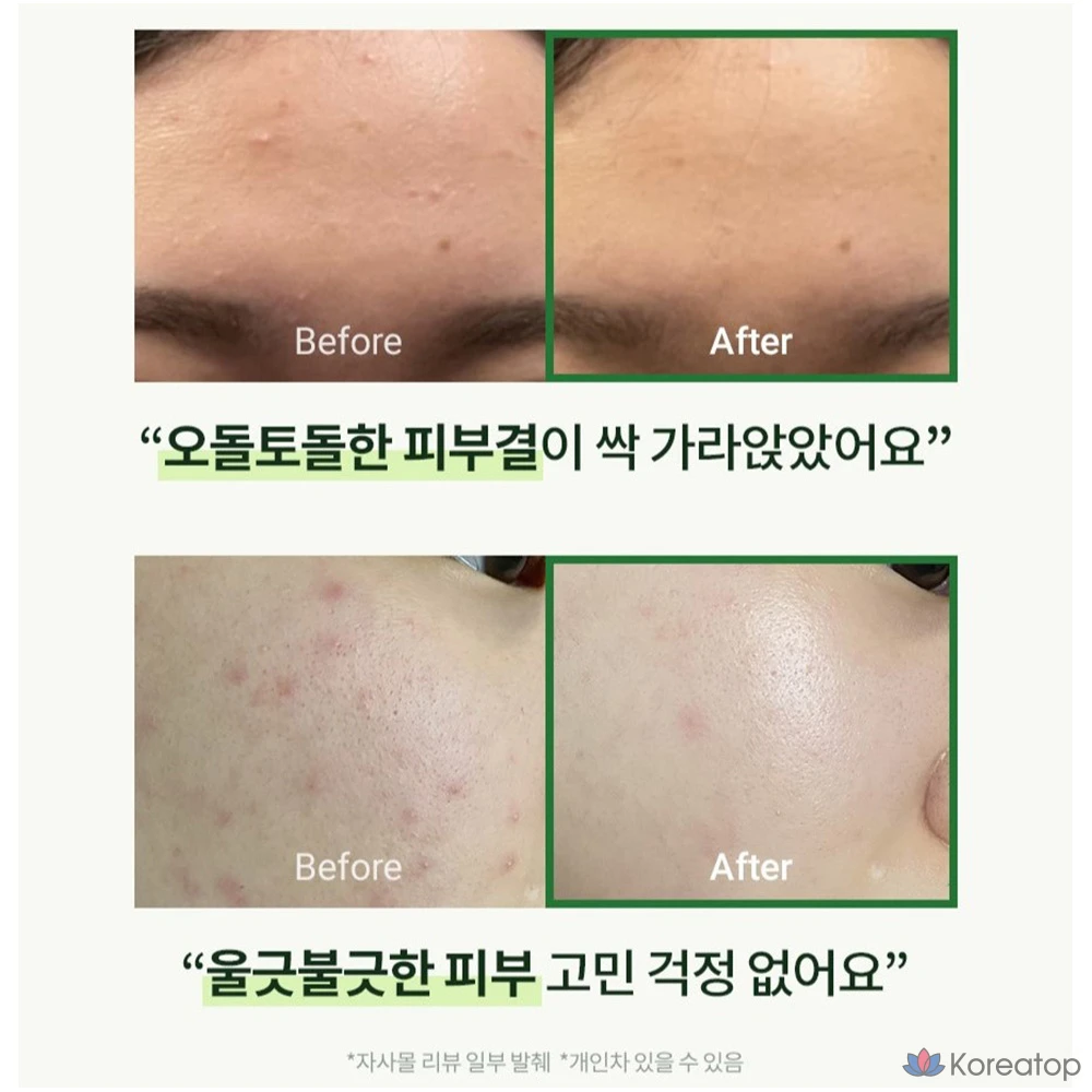 Тканевая маска для лица Milk Touch Seoyangsongak Green Hyaluron Daily Soothing Mask, 120 шт., фото 2